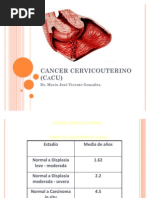 Cancer Cervicouterino (Cacu)