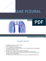 Derrame Pleural