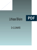 Lithiase Biliaire X