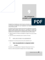 1-Implantation D - Un Alignement