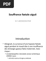 Souffrance Fœtale Aiguë