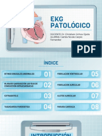 Ekg Patológico