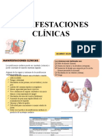 Expo de Insuficienccia Cardiaca.