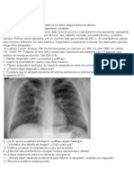 Transcripción Hemoptisis