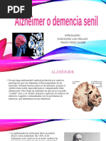 Enfermedad de Alzheimer o Demencia Senil