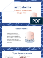 Gastrostomia