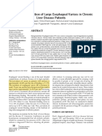 Prevalence of Variceal Bleeding in ALD Patients