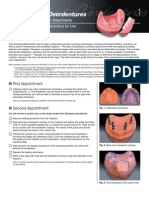 Implant Over Dentures