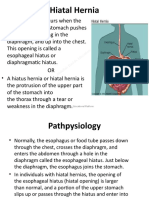 Hiatal Hernia - AHN