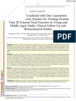 Orthopaedic Surgery - 2023 - Wen - Gamma Nail Combined With One Cannulated Compression Screw Fixation For Treating Pauwels