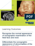 Fetal Face and Neck - Student Slides