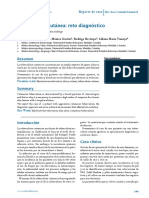 Tuberculosis Cutánea: Reto Diagnóstico: Reporte de Caso