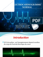 Electrocardiogramme Normal: DR A.Akachat Maitre Assistant en Cardiologie