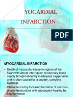 Myocardial Infarction