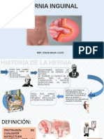 Hernia Inguinal Pre Pre