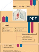 Carcinoma de Pulmon