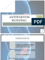 Antepartum Bleeding