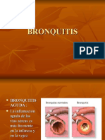 Bronquitis