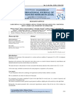 Large Renal Calculus Hidinga Renal Tumor Type Squamous Cell Carcinoma About A Rare Case and Review of Literature