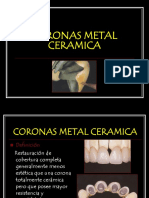 Coronas Metal Ceramica