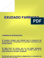 Exudado Faríngeo