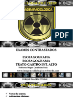 Exames Contrastados Esofagografia OBS