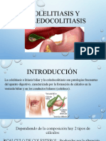 Colelitiasis y Coledocolitiasis