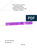 Electrocardiograma Normal y Patológico - Medicina Interna