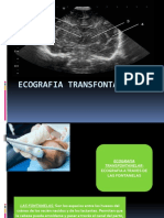 Ecografia Transfontanelar