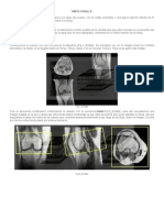 RM de Rodilla