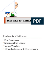 PPS UPEC PIDSP Rashes in Children Module