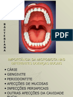 Placa Dental