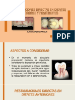 Restauraciones Directas en Dientes Anteriores y Posteriores