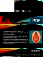 Prolapso Uterino