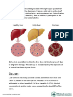 Liver Cirrhosis