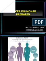 Cancer Pulmonar SJB