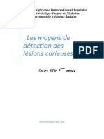 Les Moyens de Détection Des Lésions Carieuses