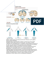 Paralisis Cerebral Infantil