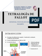 Tetralogia de Fallot