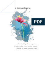 Culsuta de Electrocardiograma