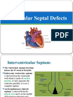 Ventricular Septal Defect