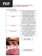 Caso Clinico Afta Bucal Cesar Atarama