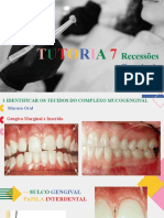 Slide Recessão Gengival