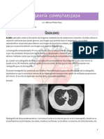 Tomografía Computarizada Generalidades