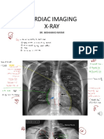 Cardio 2 - X-Ray