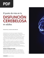 Disfunción Cerebelosa: El Punto de Mira en La