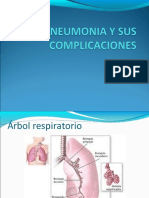 NEUMONIA