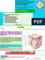 Quemaduras (Emergencias)