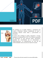 OSTEOARTROSIS