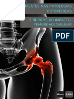 E Book Kauffer Pilates Na Sindrome Do Impacto Femoroacetabular